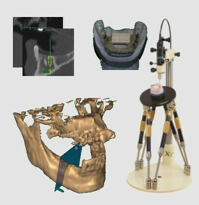Moderne Behandlungen für Ihre Zähne - Zahnarzt Kempten